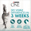 PURINA ONE Kitten Dry Cat Food Immune Defence Plus+ Chicken 1.4kg