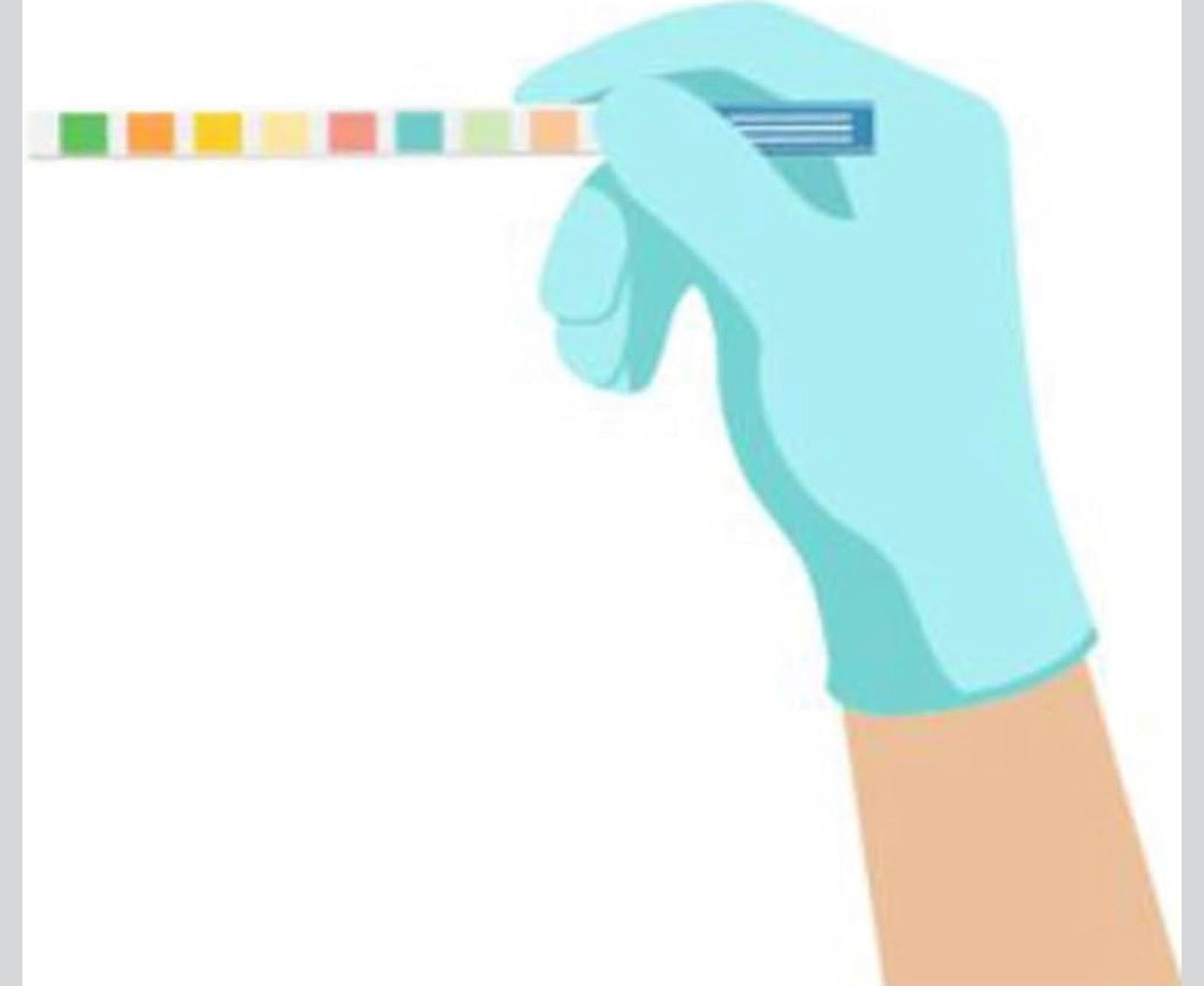 Pet Urine Testing Strips, 100 Urinalysis Parameter Tests for Dogs,Cats,Vets, Accurate Testing for Veterinarians